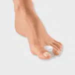 séparateur orteil hallux valgus sante pied