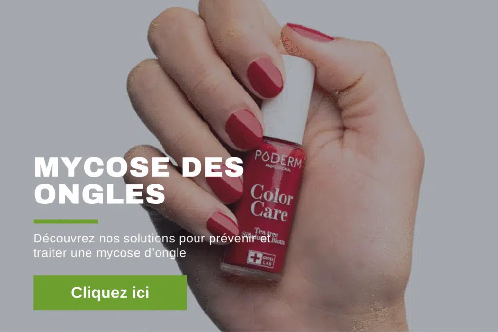 mycose_ongles